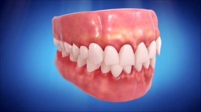Методы лечения челюстнолицевых аномалий и деформаций