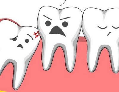 Причины боли зуба мудрости и что делать после удаления